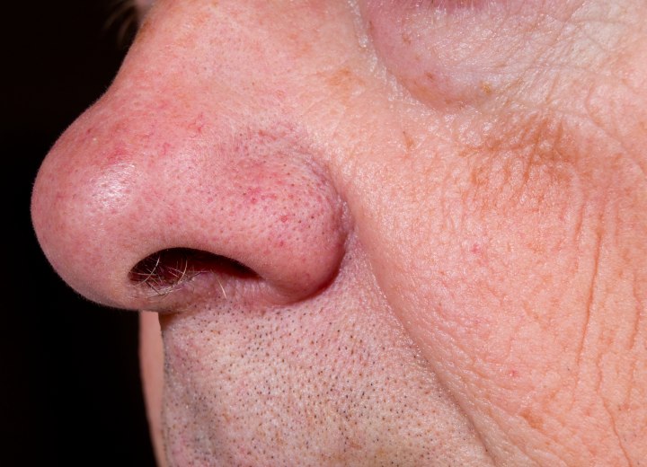 La nariz de un viejo